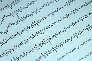 the medicine, study, electrophysiology, eeg, electroencephalography, electroencephalogram, medical, health care, the science, tech, recording, fragment, eeg, eeg, eeg, eeg, eeg